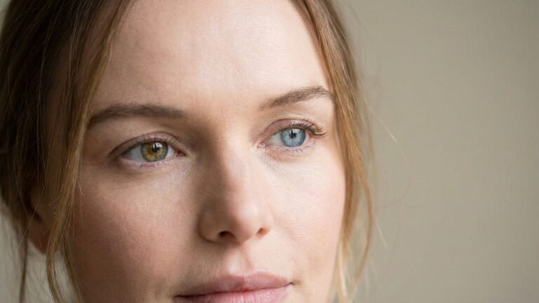 Yeux vairons vert et bleu