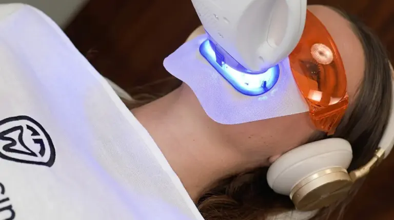 Blanchiment des dents en cabinet